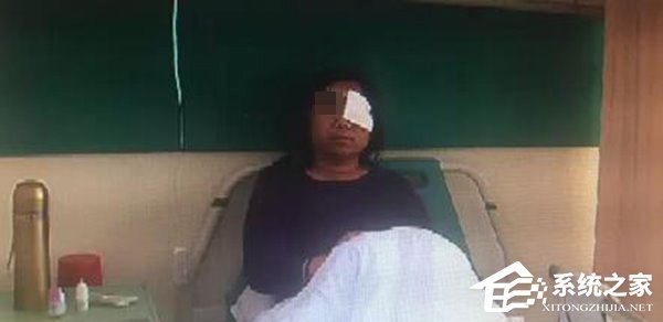 400元购买的国产山寨手机突然起火爆炸，女子眼睛受伤
