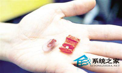 升级版折叠机器人可摘除胃壁附着异物