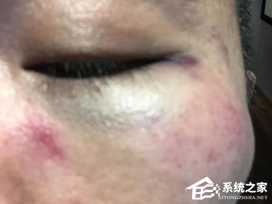 秒变“滴滴打人”！投资人张桓声称遭滴滴司机殴打