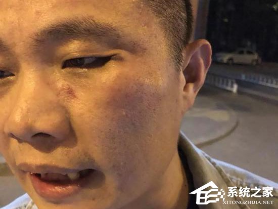 秒变“滴滴打人”！投资人张桓声称遭滴滴司机殴打