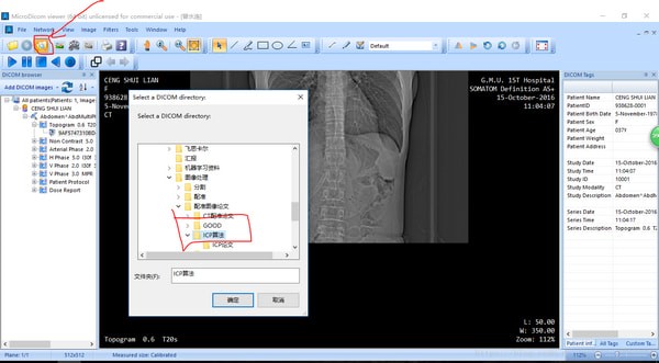 MicroDicom viewer