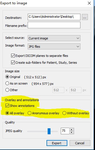 MicroDicom viewer