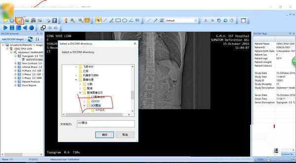 MicroDicom viewer