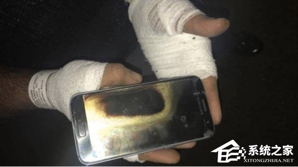 三星S7手机爆炸：加拿大男子手腕被三级烧伤