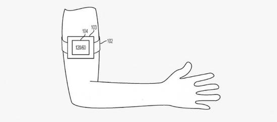 不仅仅是Apple Watch！苹果还隐藏着其它可穿戴设备
