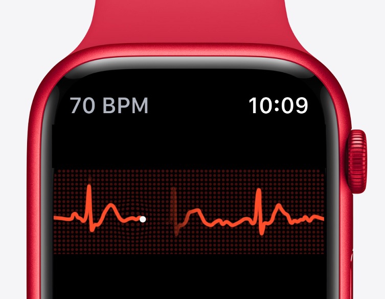 苹果 Apple Watch 手表引入雷达系统新专利