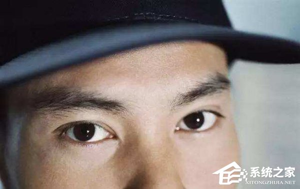 你怕不怕？小伙因长时间玩手机惨变“斗鸡眼”